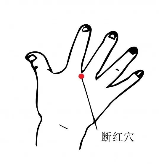 月经不调大姨妈不来怎么办,大姨妈不来反而白带来了