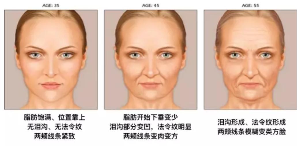 少年法令纹和痘坑显老,显老元凶法令纹