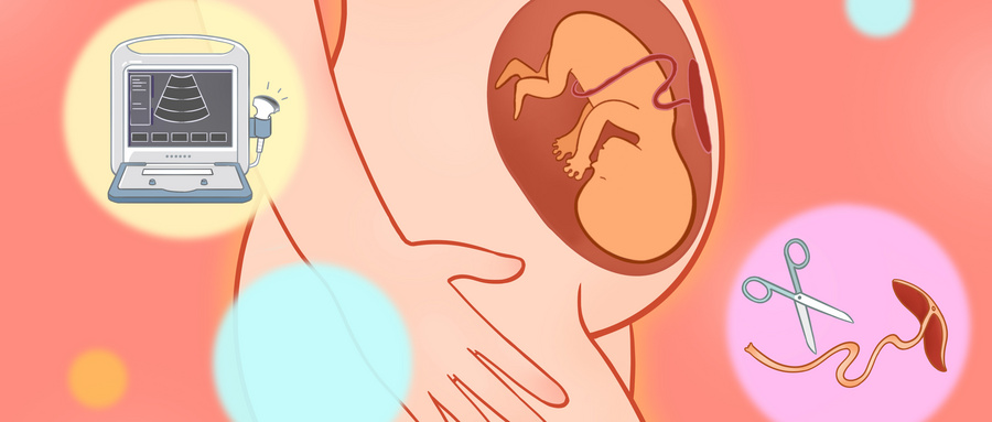 宫颈炎不可小觑，发起病来你承受不住，多关注宫颈健康