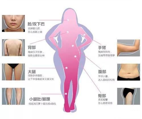想吸脂减肥具体需要怎么做,想做个吸脂去哪家医院