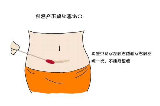 产后科学护理快速恢复正常生活,如何科学坐月子产后恢复攻略