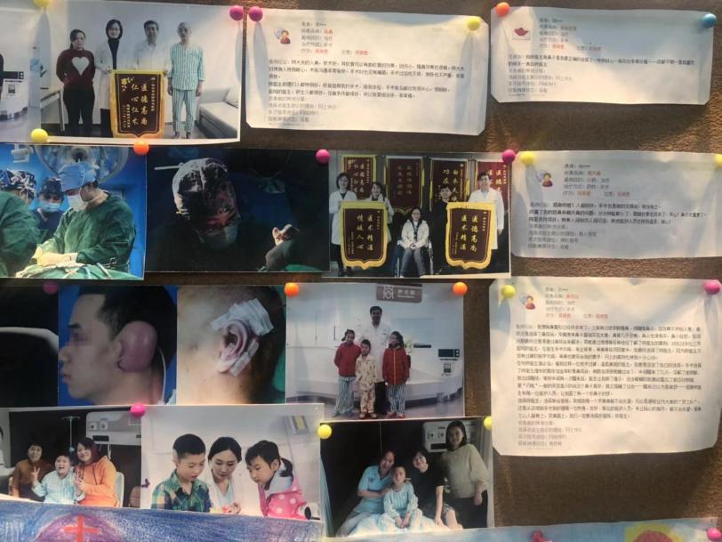 鼻子整形手术女医生,鼻整形女