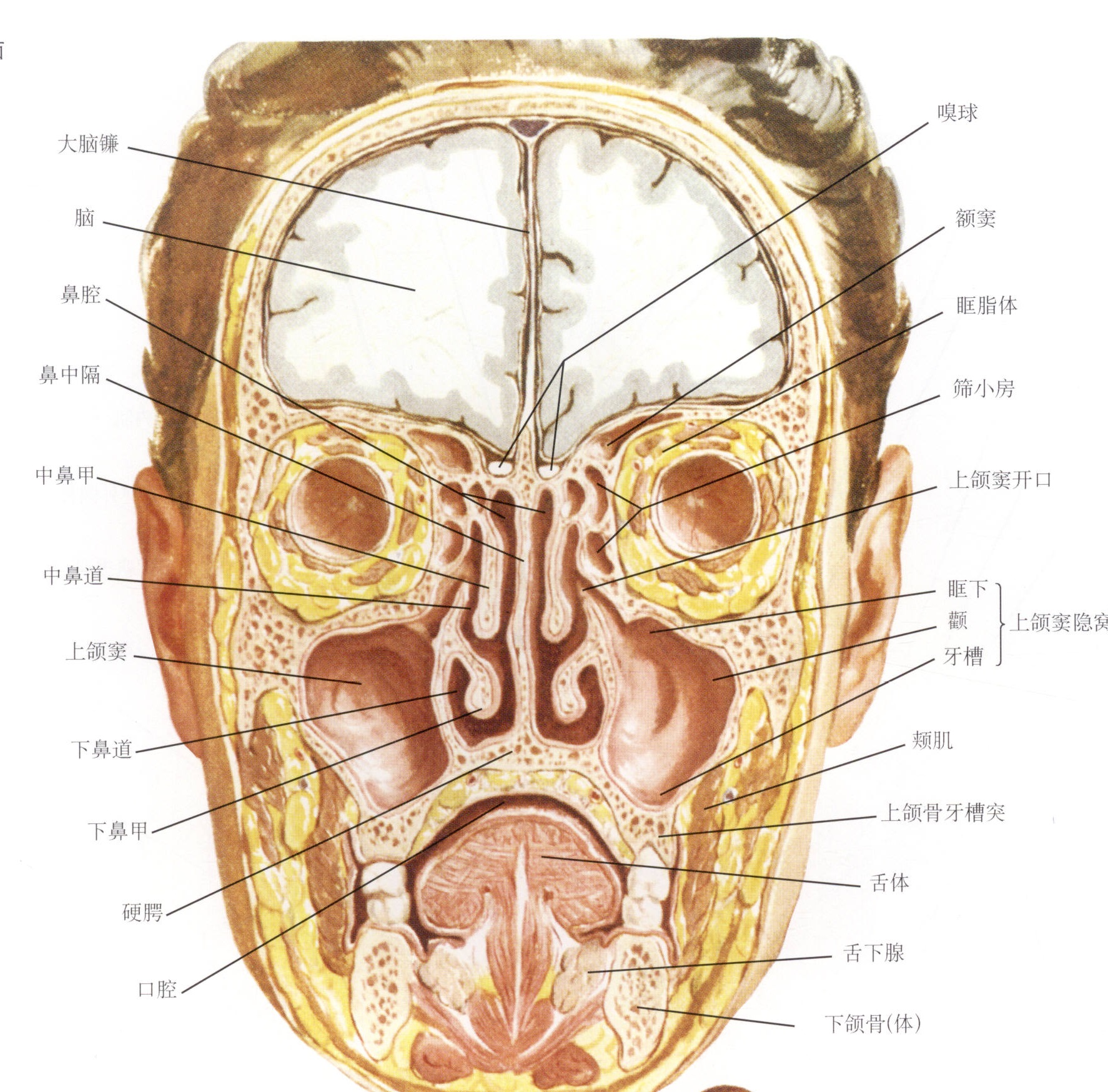 慢性鼻窦炎长期治疗用什么药,慢性鼻窦炎的案例
