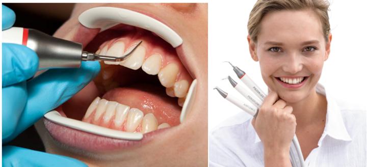 德州口腔医院洗牙团购,德州牙科整牙