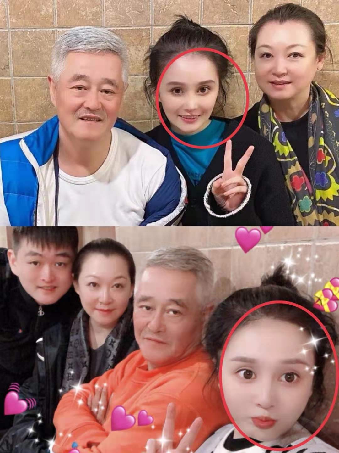 赵本山老婆谈女儿整形,赵本山女儿花30万整容遭亲妈痛批