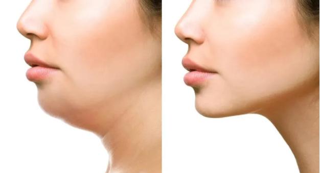 如何拥有完美的下颌线,怎么拥有好看的下颌
