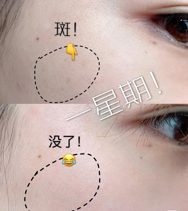 李佳琦推荐淡斑去皱美白,什么样的人最容易长细纹