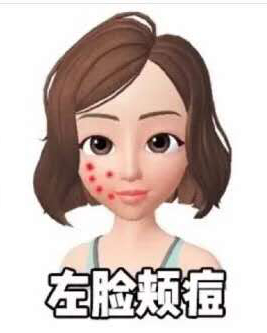 鼻翼两侧和下巴长痘什么原因引起,脸颊两边长痘是什么原因该怎么办