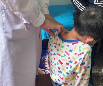 小孩衣服缝按扣方法,孩子脱裤子导致了胯关节脱位