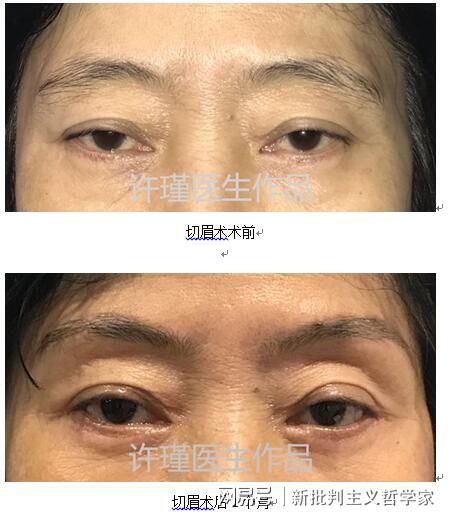 名医专访丨上海交通大学医学院附属同仁医院许瑾：面部美容整形