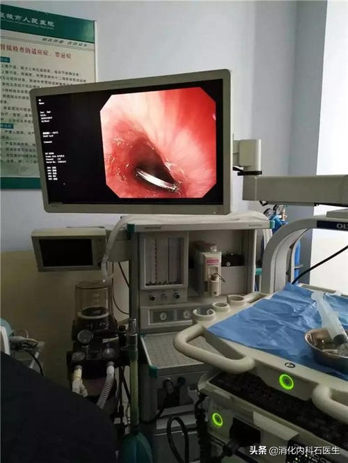 儿童胃痛能吃奥美拉唑吗,小孩胃痛胃胀可以做胃镜吗