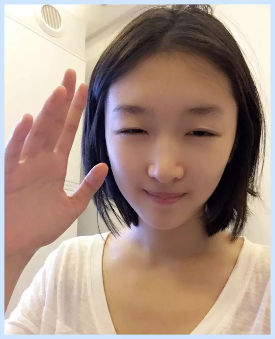 痘印有红痘印黑痘印怎么解决,大面积的痘印红痘印黑痘印怎么遮