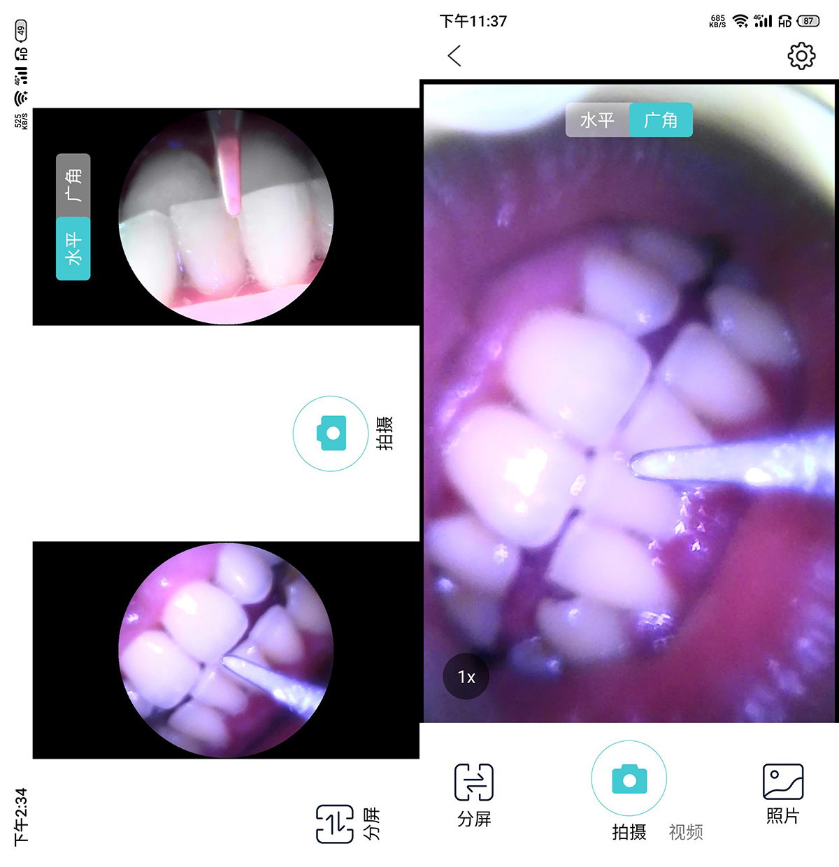 去除牙垢牙刷测评,洁牙神器和普通牙刷哪个好
