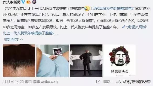 20岁脱发和45岁脱发的区别,听说90后第一批已经开始脱发了