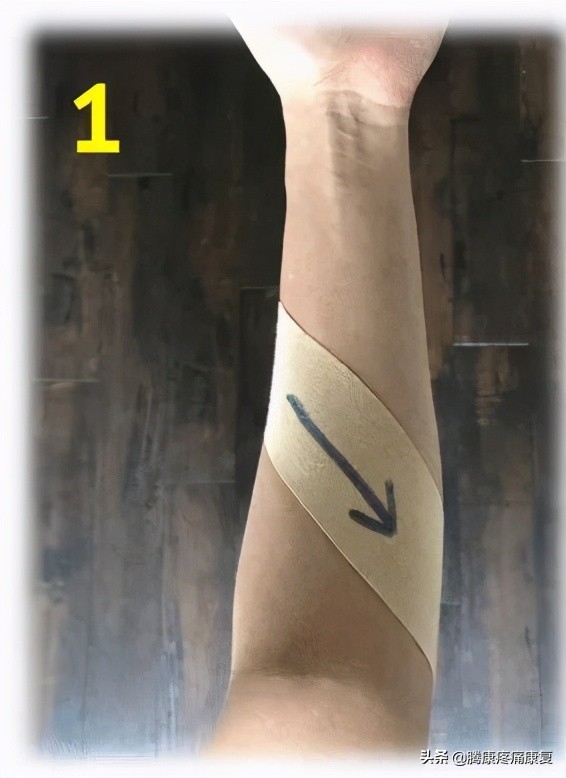 腕和手的多处屈肌和肌腱损伤,前臂神经卡压原因