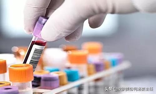 治疗痤疮用的避孕药有哪些,为什么治疗痘痘需要避孕药