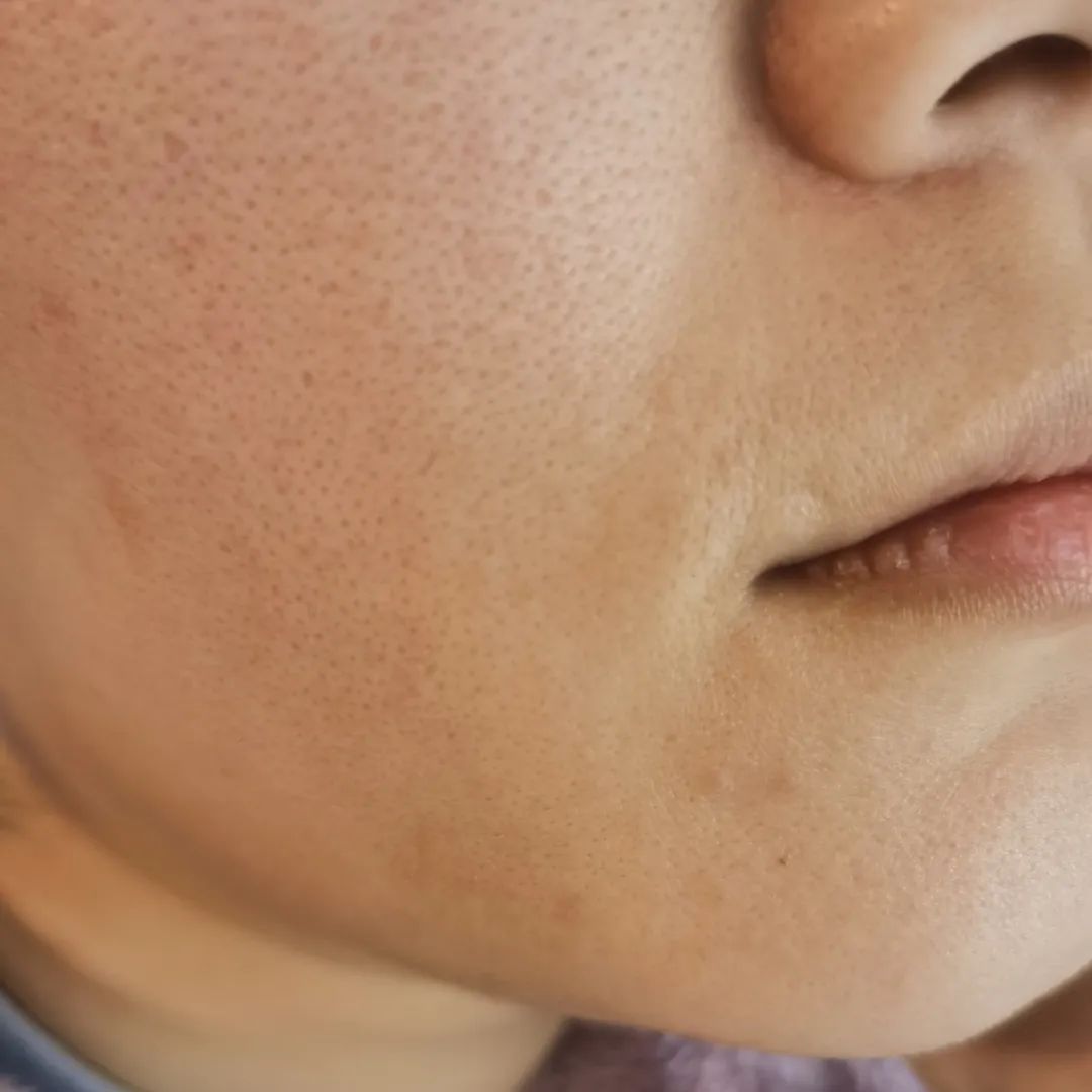 科颜氏抗初老精华露元气弹,科颜氏小白瓶跟元气弹