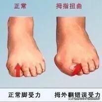 如何快速瘦小腿学生党一天有效,如何快速瘦小腿小学生