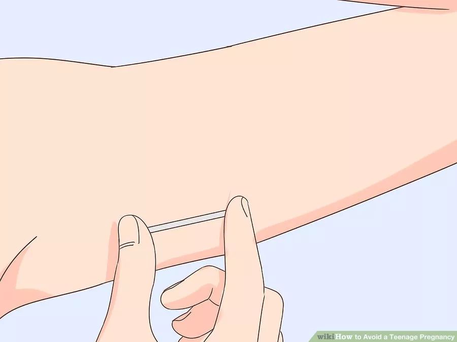 有什么办法可以及时避孕,可以采取哪些方法避孕