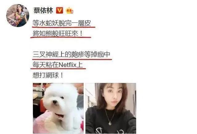 蔡依林、马思纯纷纷中招?痛如刀割的带状疱疹,真的致命吗?