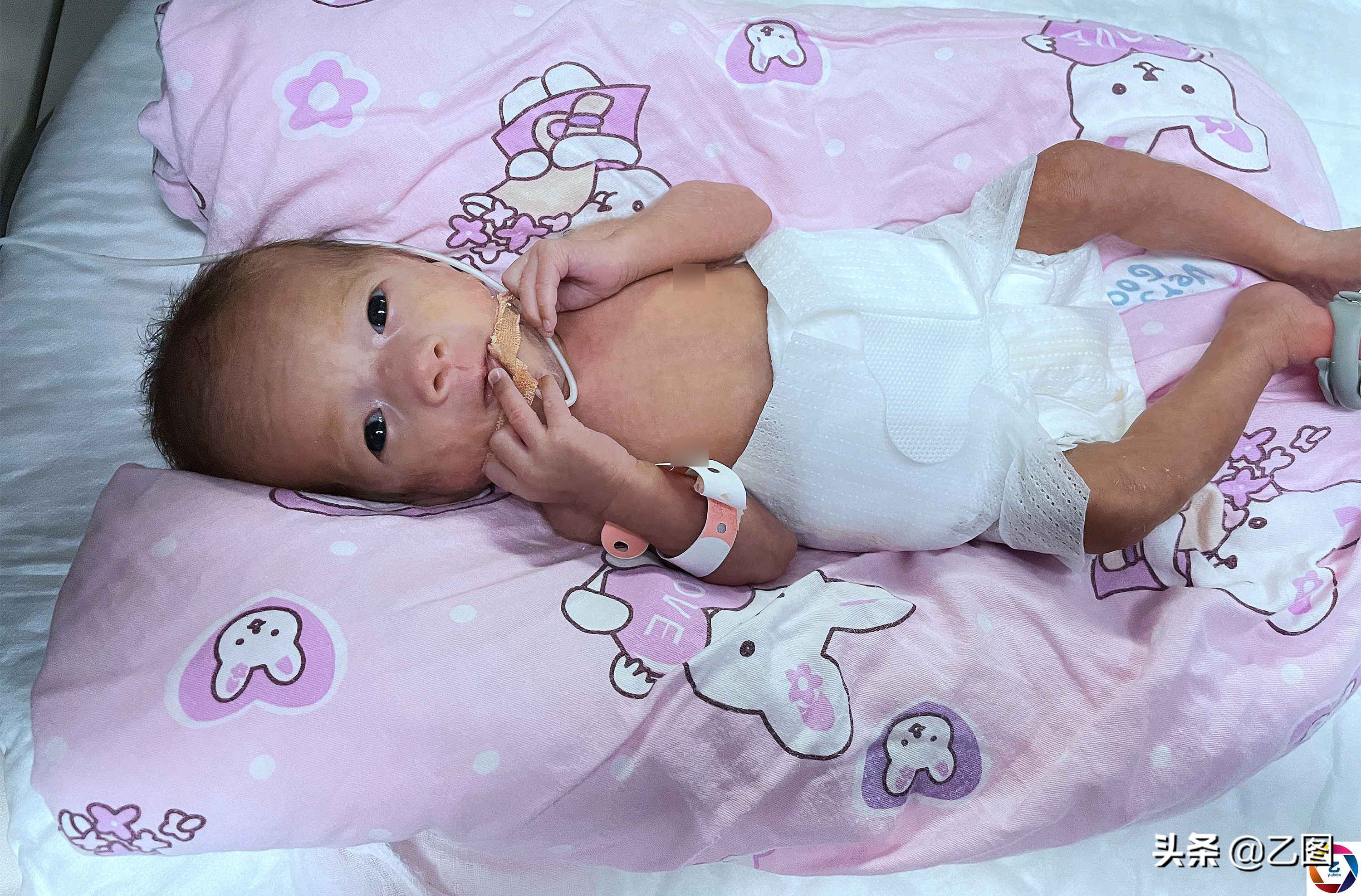 早产儿为什么一出生病危,早产儿1斤5活下来了