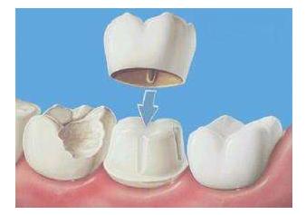 大连齿医生口腔科普没有蛀牙还牙疼？这4个隐患不能忽视