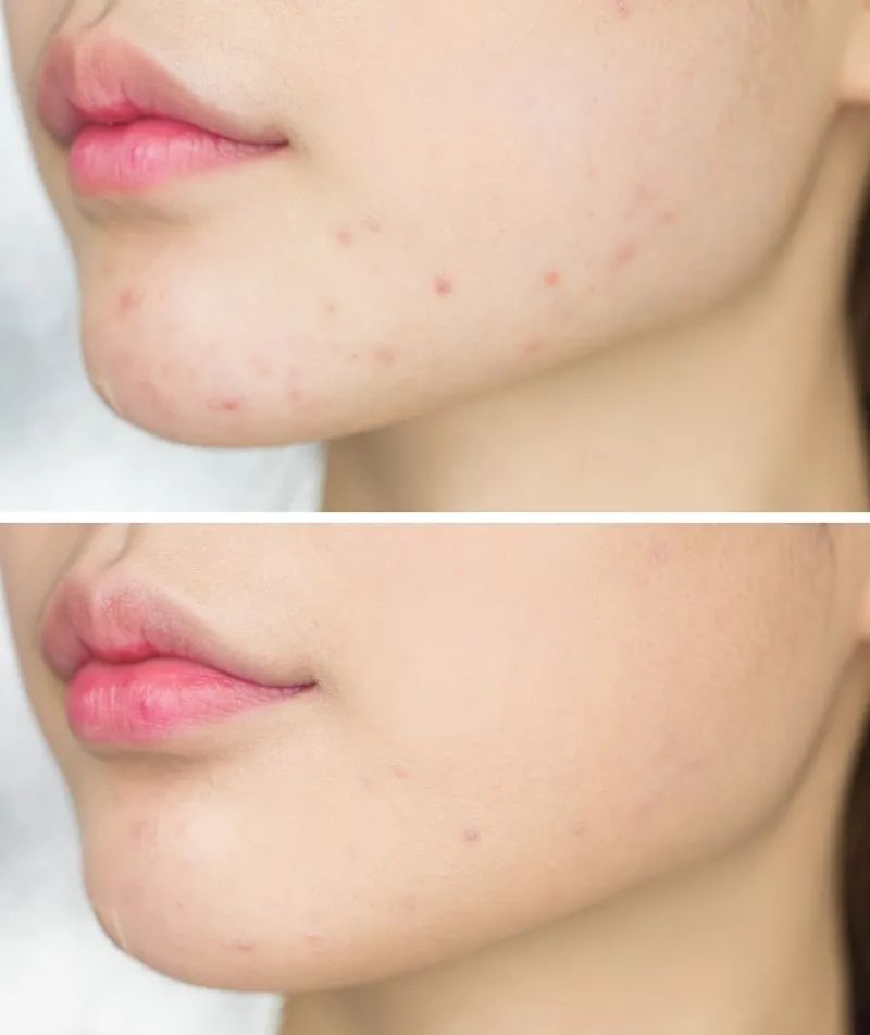 超补水超好用的芦荟胶,如果补水保湿只用芦荟胶可以吗