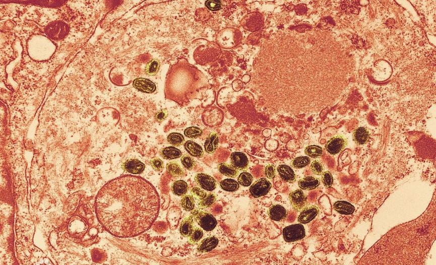 病菌对人类历史的影响,人类与细菌的进化关系