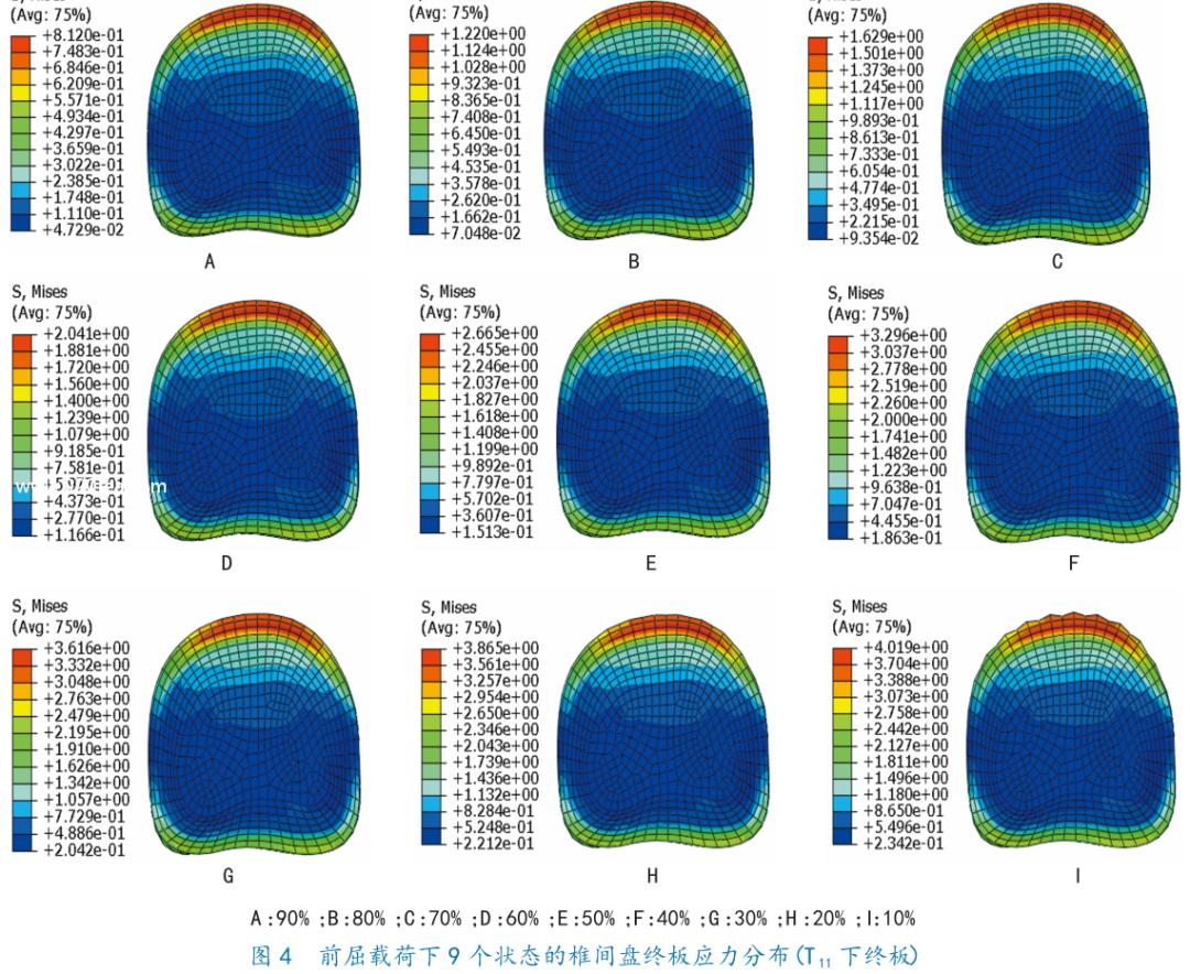 腰1椎体压缩骨折复发要卧床几天,胸12腰4椎体压缩骨折几级工伤