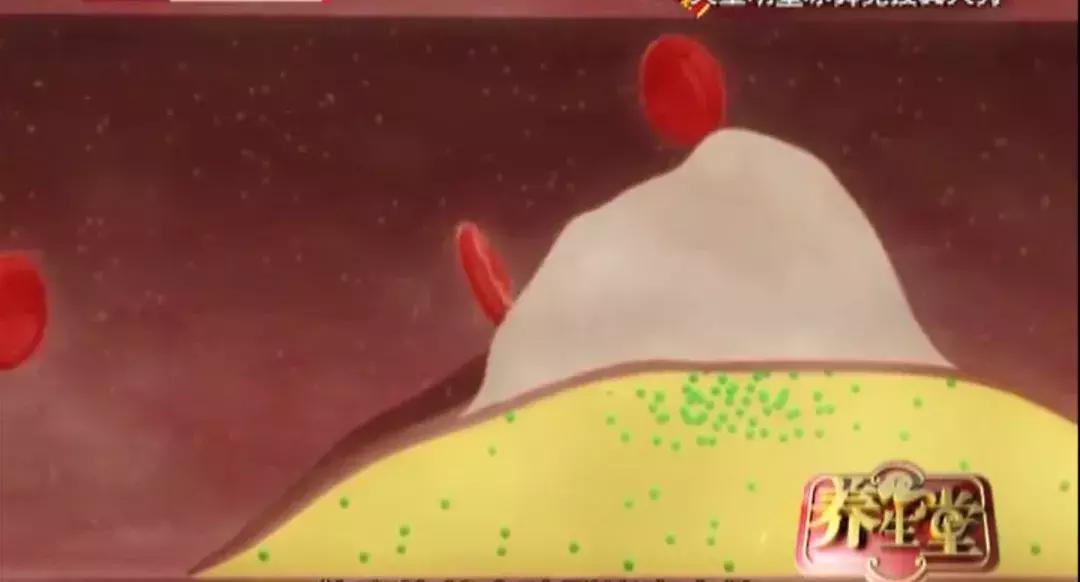 人猝死前身体有什么信号,人猝死前10大征兆