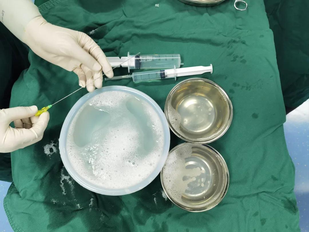 淄博妇幼保健院无痛要预约吗,淄博妇幼保健院无创plus