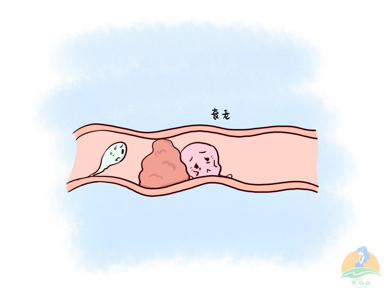 精子和卵子排出后会相遇吗,卵子排出后24小时会与精子结合吗