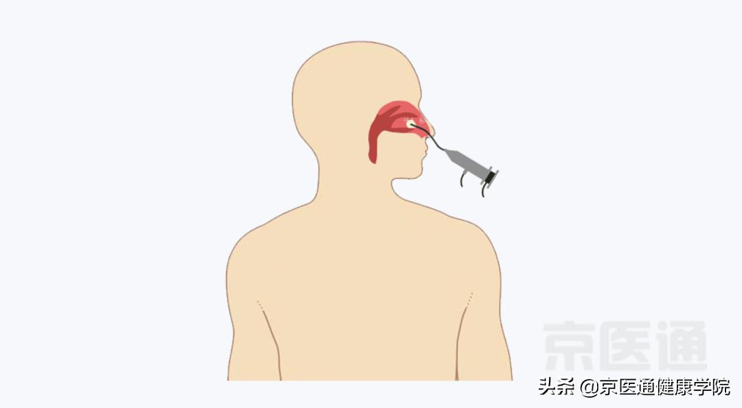 胃镜鼻腔镜,胃镜和肠镜以及胃肠镜的区别