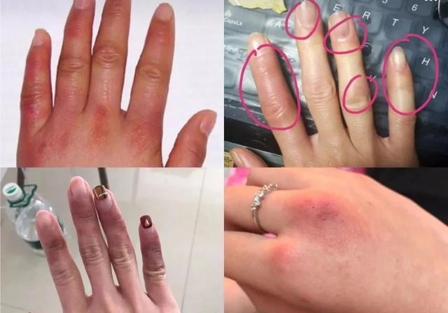 王凯手被投保3600万？林更新堵车时不忘涂手霜，我承认自己不精致