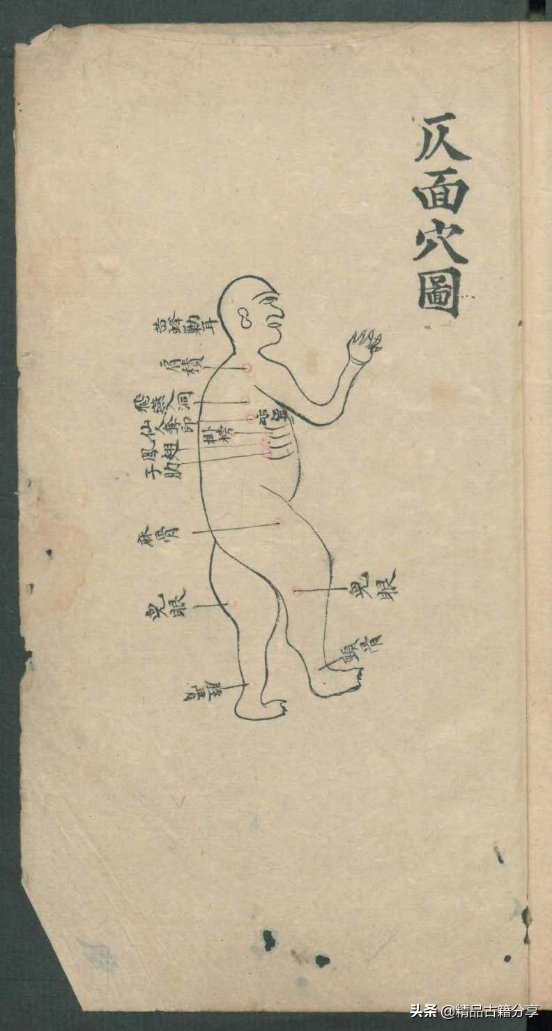 中医类抄本跌打损伤方面的医书欢迎阅读