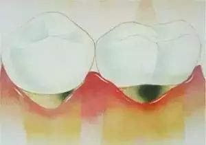 牙齿变长了黄的部分是牙根吗,牙齿长得细长有什么说法吗