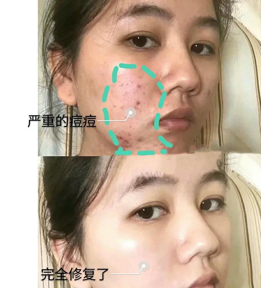 「好评反馈来啦」疯狂打call，实力表白｜为什么*干粉冻**这么受欢迎