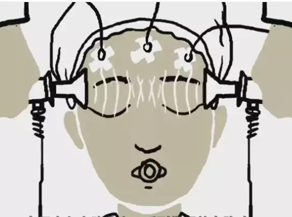 抑郁无抽搐电休克治疗,无抽搐电休克治疗步骤