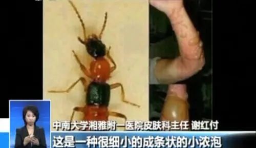 广州近期出现的变异蜗牛,深圳雨后巨型蜗牛