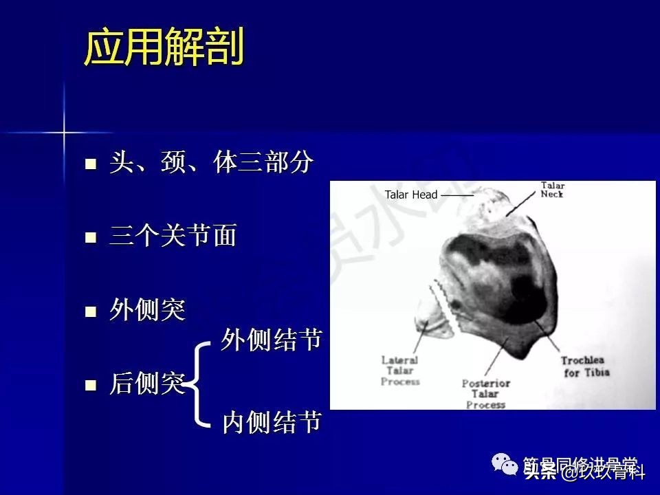距骨骨折的治疗原则,距骨骨折如何调理
