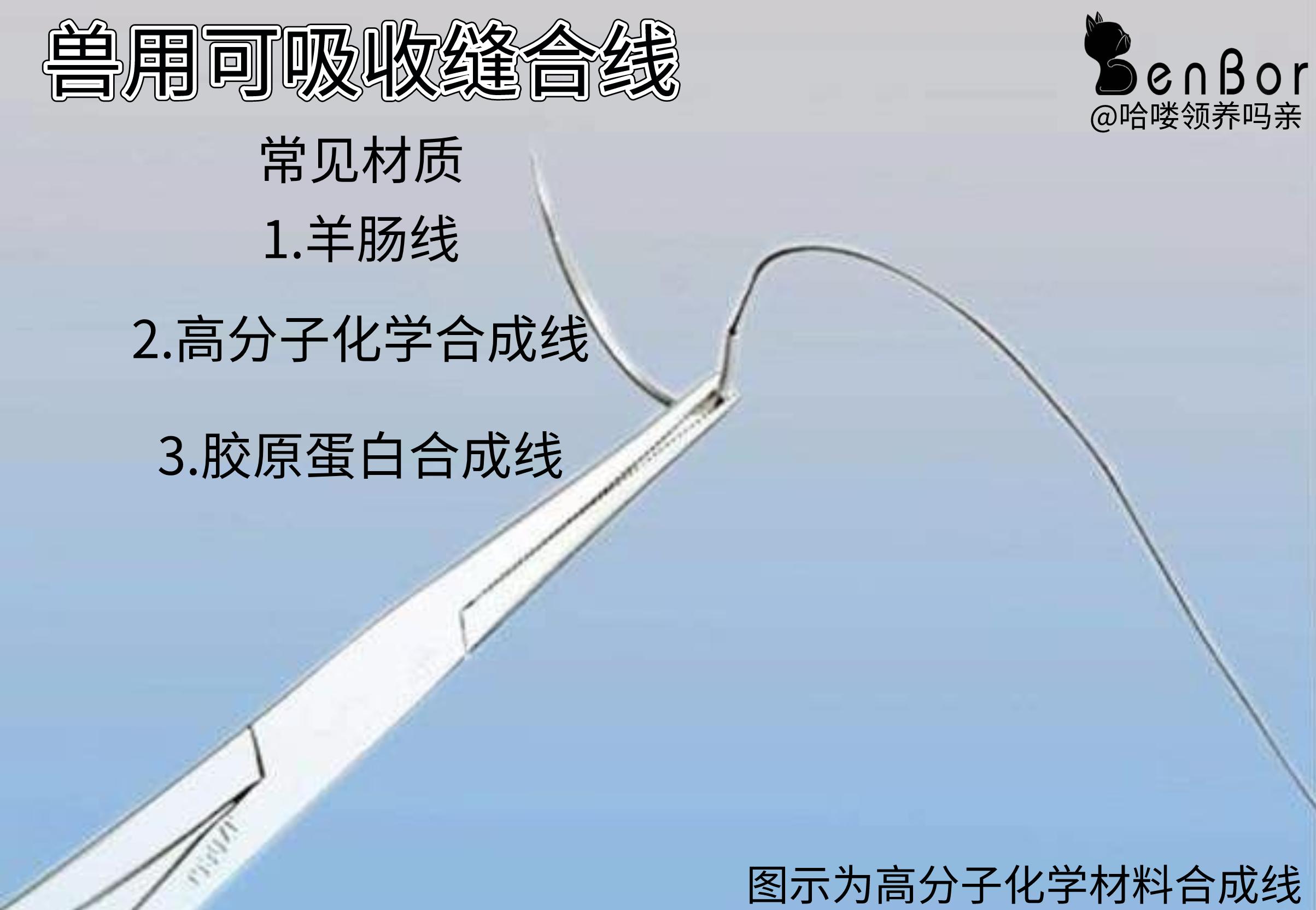 免拆线到底是拆还是不拆好,免拆线和普通线的利弊
