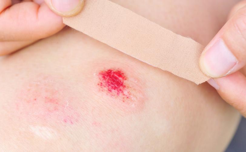 人类进化虱子,虱子与人类共存千万年