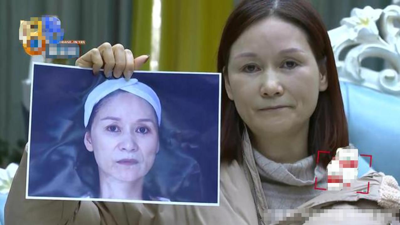 做医美没效果可以得到赔偿吗,做医美失败了修复要钱吗