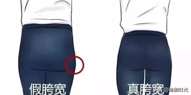 大腿粗，屁股肥，可能是假胯宽！全套矫正方案让你“又窄又瘦”