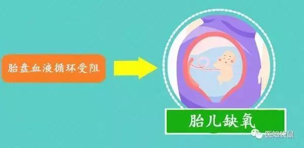 生孩子打催产素好吗,生孩子打催产素胎儿会缺氧吗