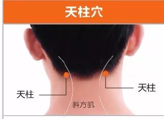 天柱穴,天柱穴旁安眠穴