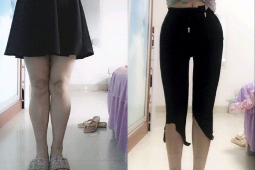 郑爽同款漫画腿不动刀也能get？吴昕的萝卜腿有救了