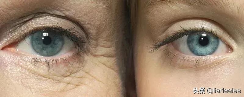 防眼角皱纹最好的方法,眼部皱纹多特别显老