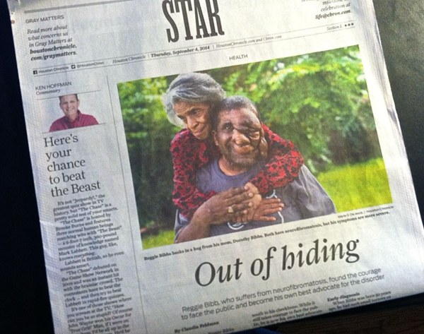 全身内外都是瘤子是什么病,全身长满瘤子怎么治疗