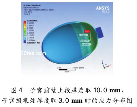 有限元应力分析结果有单位吗,有限元剖分模型
